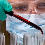 Bluttest im Labor
