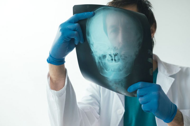 Radiologe begutachtet Röntgenbild