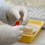 Ein Labor Test